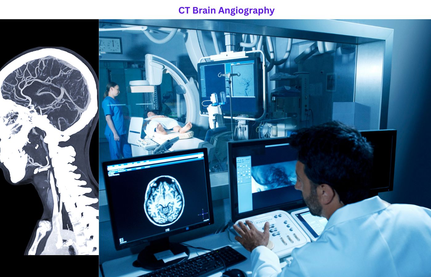 CT Brain Angiography 